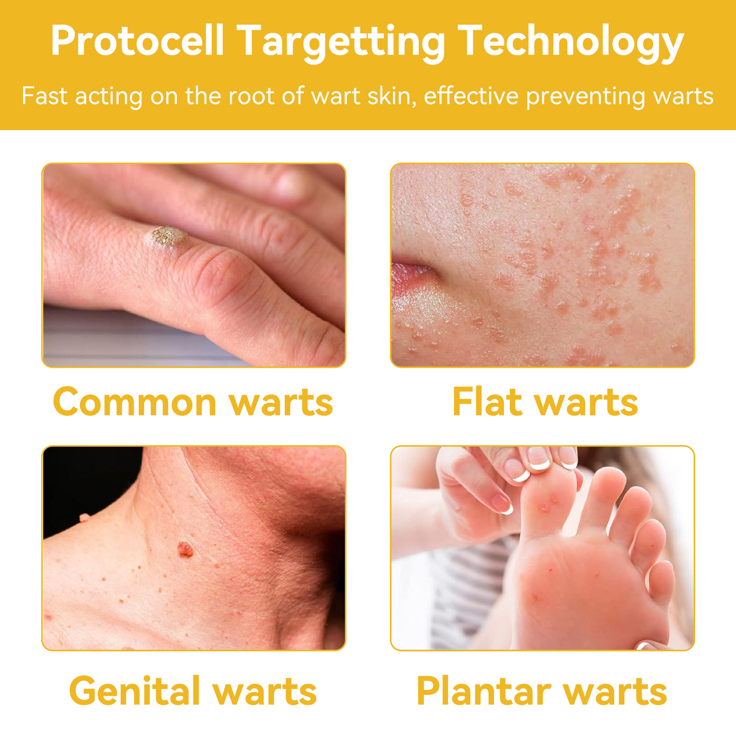 ðµïžðð¢ðððð¢â¢ Bee Venom Skin Treatment CreamïŒðŽðŽð· ð
ððððððððððïŒ