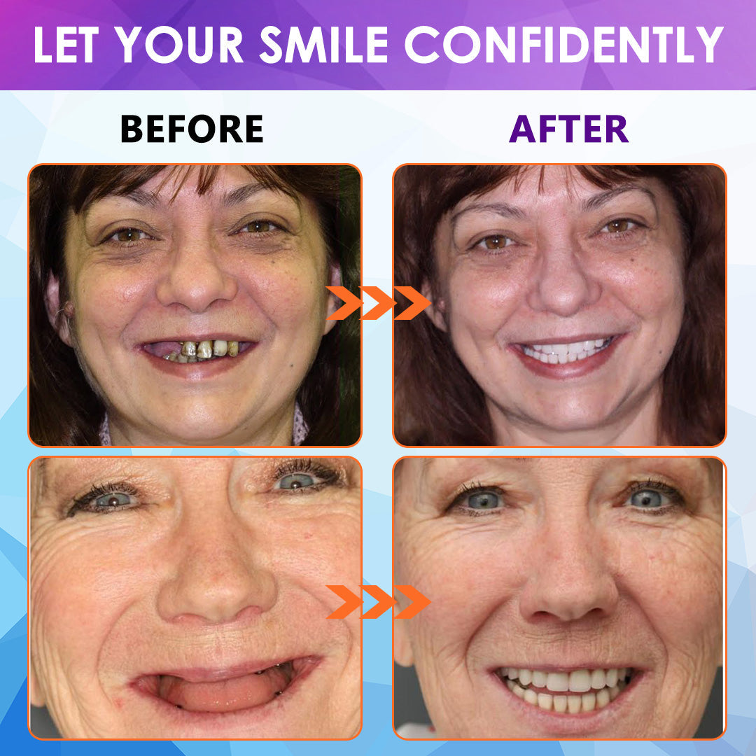 Hermsa™ Silicone Lined Denture Set (BDA Recommended) (LIMITED TIME DISCOUNT LAST 30 MINUTES ⏰)