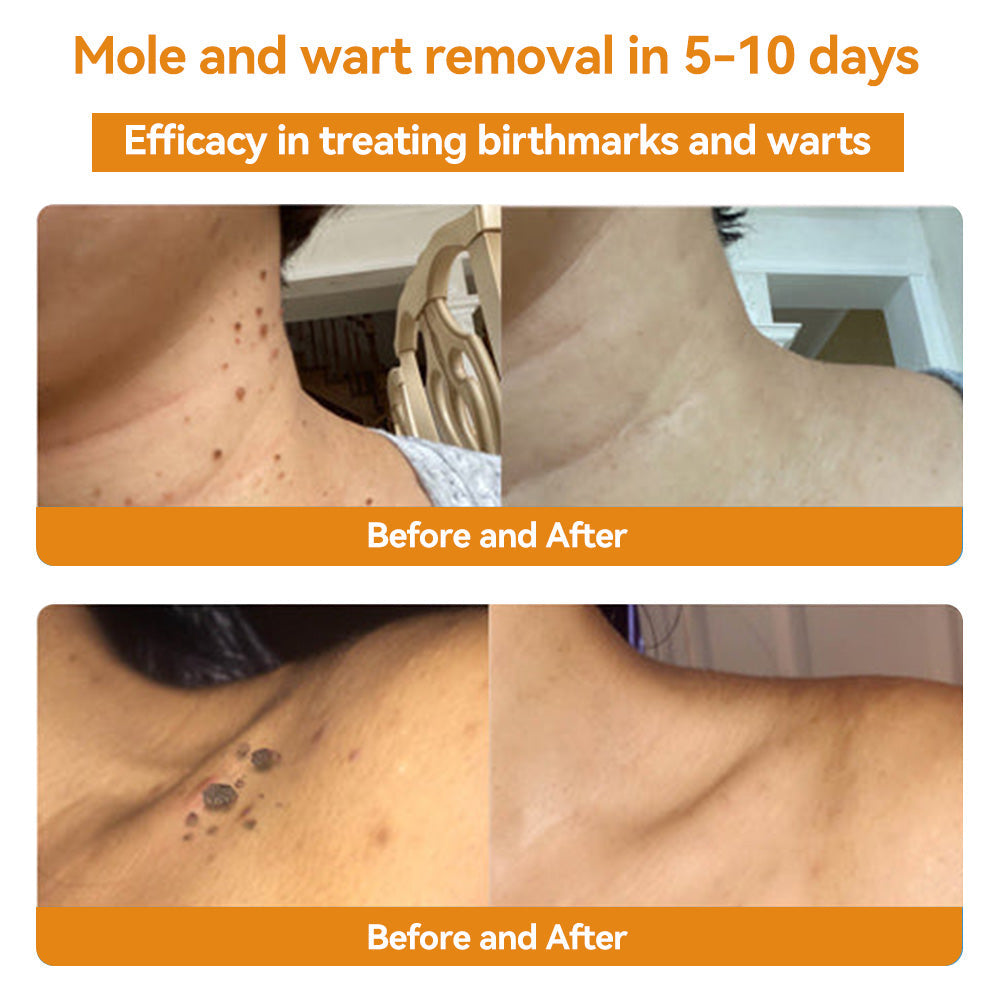 ðµïžðð¢ðððð¢â¢ Bee Venom Skin Treatment CreamïŒðŽðŽð· ð
ððððððððððïŒ