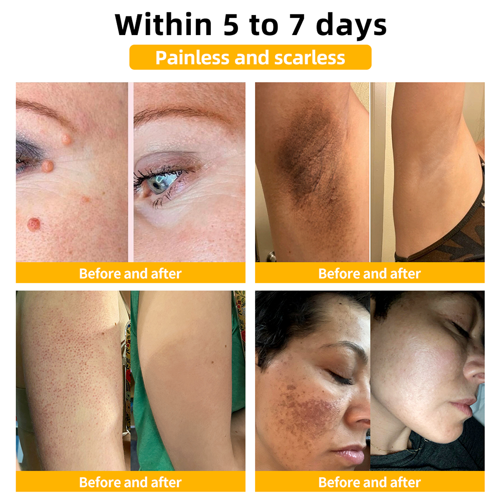 ðµïžðð¢ðððð¢â¢ Bee Venom Skin Treatment CreamïŒðŽðŽð· ð
ððððððððððïŒ