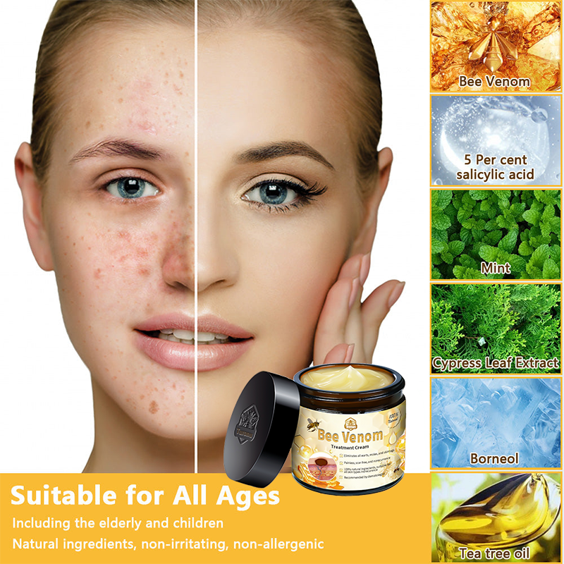 ðµïžðð¢ðððð¢â¢ Bee Venom Skin Treatment CreamïŒðŽðŽð· ð
ððððððððððïŒ