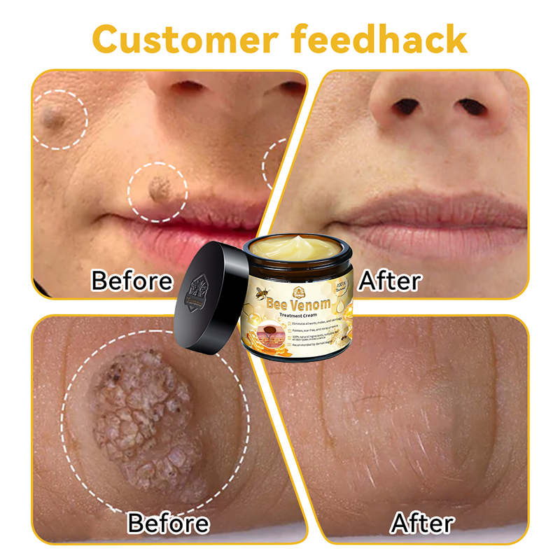 ðµïžðð¢ðððð¢â¢ Bee Venom Skin Treatment CreamïŒðŽðŽð· ð
ððððððððððïŒ