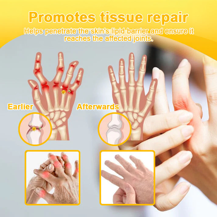 Aetheris⢠Bee-Venom Pain-Relief Bone Healing Cream (Especially for older adults &AAOS recommendsð§ââïž)ðð