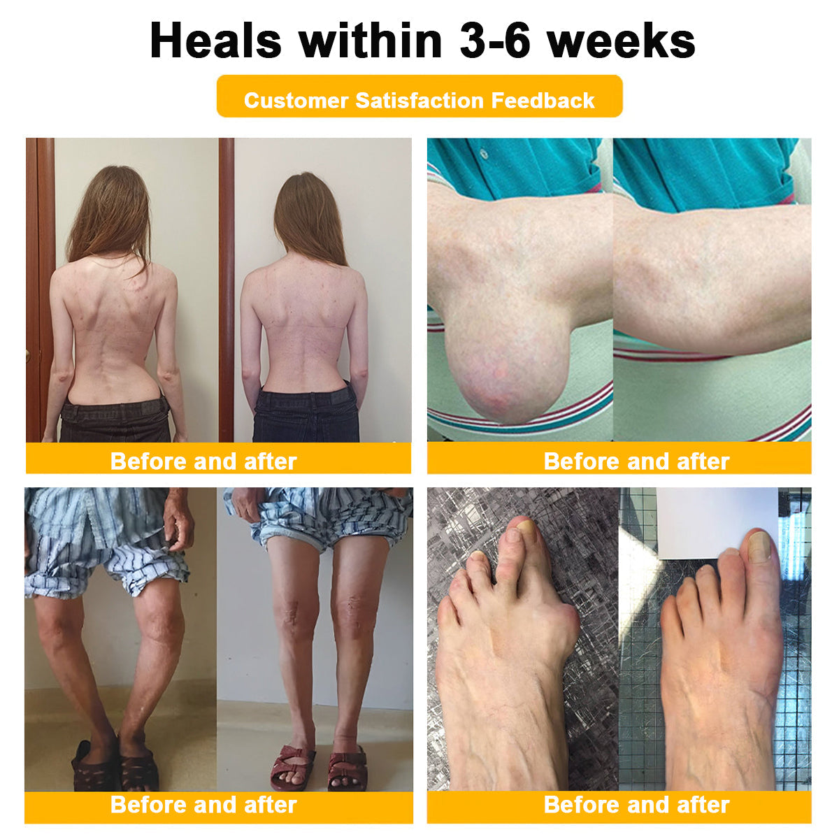 Aetheris⢠Bee-Venom Pain-Relief Bone Healing Cream (Especially for older adults &AAOS recommendsð§ââïž)ðð