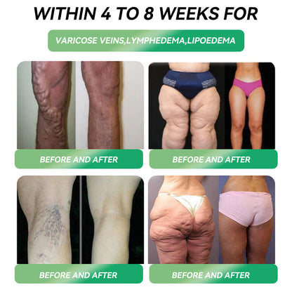 🇺🇸Official Store | Myo Clinic GLP-1 SIX-IN-ONE Health Solution Oral Liquid (Just once a day, visible changes in 7 days) For obesity, cardiovascular health, diabetes, sleep apnea, Gut Health, joint issues, and more