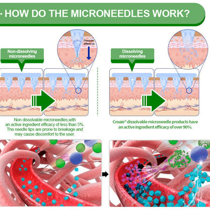 [See results in 7 days]🔔Croaie® Nano Microneedle Patch SMGT-GLP-1 & Matrixyl™  3000（Painless, long-lasting, addressing diabetes, obesity, and cardiovascular diseases）💚
