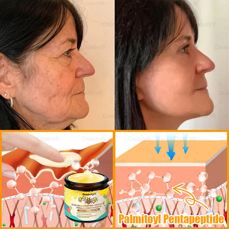 🔥 🗽Made & Shipped from USA | Clinically Proven: Daasry® Bee Venom Treatment Cream with bee venom peptides, botulinum toxin, hyaluronic acid, and collagen💧. Targets wrinkles, fine lines, sagging, stretch marks, dark spots—firming, lifting and more