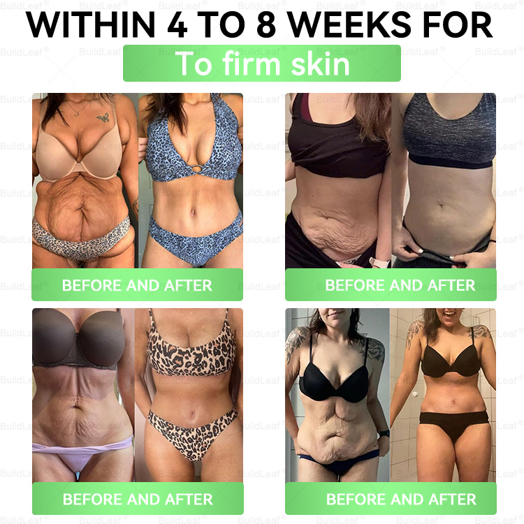 US Online | Myo Clinic® 𝗚𝗟𝗣-𝟭 𝟖-𝗶𝗻-𝟭 𝗦𝗹𝗶𝗺 & 𝑯𝒆𝒂𝒍𝒕𝒉𝐲 𝑶𝒓𝒂𝒍 𝑺𝒐𝒍𝒖𝒕𝒊𝒐𝒏(𝑂𝑛𝑐𝑒 𝑎 𝑑𝑎𝑦, 𝑣𝑖𝑠𝑖𝑏𝑙𝑒 𝑟𝑒𝑠𝑢𝑙𝑡𝑠 𝑖𝑛 7 𝑑𝑎𝑦𝑠)  ✅ 𝗦𝘂𝗽𝗽𝗼𝗿𝘁𝘀 𝗼𝗯𝗲𝘀𝗶𝘁𝘆, 𝗰𝗮𝗿𝗱𝗶𝗼𝘃𝗮𝘀𝗰𝘂𝗹𝗮𝗿 𝗵𝗲𝗮𝗹𝘁𝗵, 𝗱𝗶𝗮𝗯𝗲𝘁𝗲𝘀, 𝘀𝗹𝗲𝗲𝗽 𝗮𝗽𝗻𝗲𝗮, 𝗴𝘂𝘁 𝗵𝗲𝗮𝗹𝘁𝗵, 𝗷𝗼𝗶𝗻𝘁 𝗶𝘀𝘀𝘂𝗲𝘀, 𝐰𝐡𝐢𝐥𝐞 𝐚𝐥𝐬𝐨 𝐟𝐢𝐫𝐦𝐢𝐧𝐠 𝐭𝐡𝐞 𝐬𝐤𝐢𝐧 𝐚𝐧𝐝 𝐛𝐨𝐨𝐬𝐭𝐢𝐧𝐠 𝐞𝐧𝐞𝐫𝐠𝐲.
