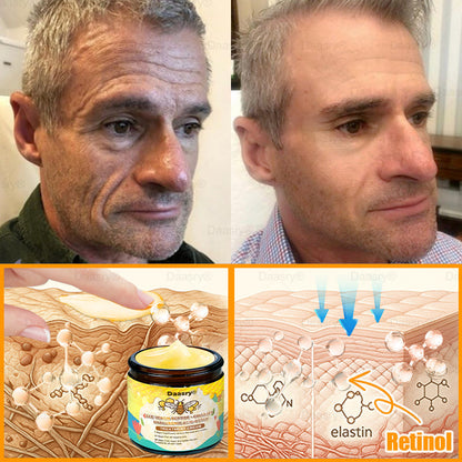 🔥 🗽Made & Shipped from USA | Clinically Proven: Daasry® Bee Venom Treatment Cream with bee venom peptides, botulinum toxin, hyaluronic acid, and collagen💧. Targets wrinkles, fine lines, sagging, stretch marks, dark spots—firming, lifting and more