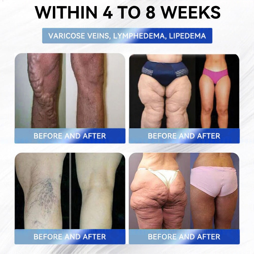 Official Store | Myo Clinic® Longevity GLP-1 8-in-1 Slim & Healthy Oral Solution(Once a day, visible results in 7 days) Supports obesity, cardiovascular health, diabetes, sleep apnea, gut health, joint issues, while also firming the skin