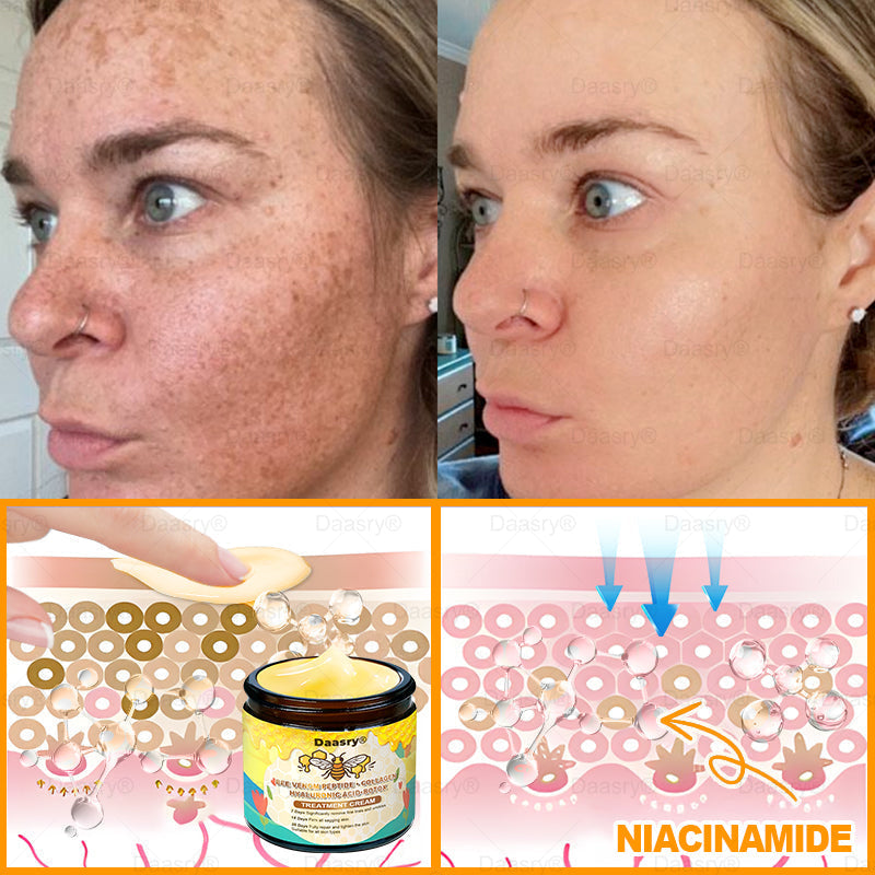 🔥 🗽Made & Shipped from USA | Clinically Proven: Daasry® Bee Venom Treatment Cream with bee venom peptides, botulinum toxin, hyaluronic acid, and collagen💧. Targets wrinkles, fine lines, sagging, stretch marks, dark spots—firming, lifting and more