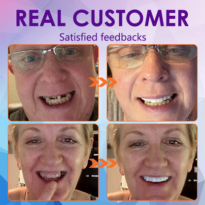 Hermsa™ Silicone Lined Denture Set (BDA Recommended) (LIMITED TIME DISCOUNT LAST 30 MINUTES ⏰)
