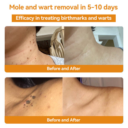 🏵️𝑇𝑢𝑟𝑜𝑛𝑢™ Bee Venom Skin Treatment Cream（𝐴𝐴𝐷 𝑅𝑒𝑐𝑜𝑚𝑚𝑒𝑛𝑑𝑒𝑑）