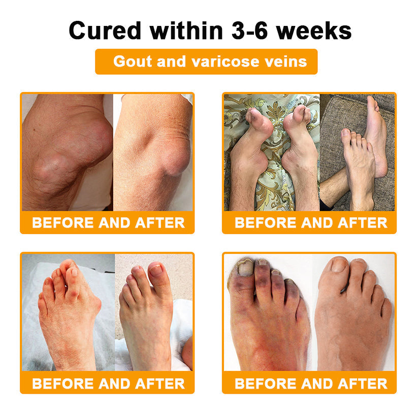 Aetheris™ Bee-Venom Pain-Relief Bone Healing Cream (Especially for older adults &AAOS recommends🧑‍⚕️)🐝🐝