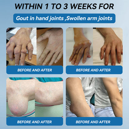LOTMAY® BPC-157 Joint & Muscle Treatment Cream🦴Treats Arthritis, Neuropathy, Rheumatism, Sports Injuries & More 🌹
