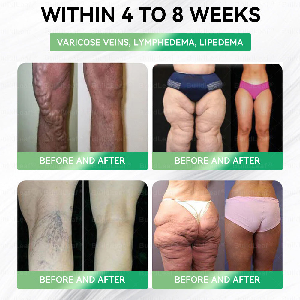 US Online | Myo Clinic® 𝗚𝗟𝗣-𝟭 𝟖-𝗶𝗻-𝟭 𝗦𝗹𝗶𝗺 & 𝑯𝒆𝒂𝒍𝒕𝒉𝐲 𝑶𝒓𝒂𝒍 𝑺𝒐𝒍𝒖𝒕𝒊𝒐𝒏(𝑂𝑛𝑐𝑒 𝑎 𝑑𝑎𝑦, 𝑣𝑖𝑠𝑖𝑏𝑙𝑒 𝑟𝑒𝑠𝑢𝑙𝑡𝑠 𝑖𝑛 7 𝑑𝑎𝑦𝑠)  ✅ 𝗦𝘂𝗽𝗽𝗼𝗿𝘁𝘀 𝗼𝗯𝗲𝘀𝗶𝘁𝘆, 𝗰𝗮𝗿𝗱𝗶𝗼𝘃𝗮𝘀𝗰𝘂𝗹𝗮𝗿 𝗵𝗲𝗮𝗹𝘁𝗵, 𝗱𝗶𝗮𝗯𝗲𝘁𝗲𝘀, 𝘀𝗹𝗲𝗲𝗽 𝗮𝗽𝗻𝗲𝗮, 𝗴𝘂𝘁 𝗵𝗲𝗮𝗹𝘁𝗵, 𝗷𝗼𝗶𝗻𝘁 𝗶𝘀𝘀𝘂𝗲𝘀, 𝐰𝐡𝐢𝐥𝐞 𝐚𝐥𝐬𝐨 𝐟𝐢𝐫𝐦𝐢𝐧𝐠 𝐭𝐡𝐞 𝐬𝐤𝐢𝐧 𝐚𝐧𝐝 𝐛𝐨𝐨𝐬𝐭𝐢𝐧𝐠 𝐞𝐧𝐞𝐫𝐠𝐲.