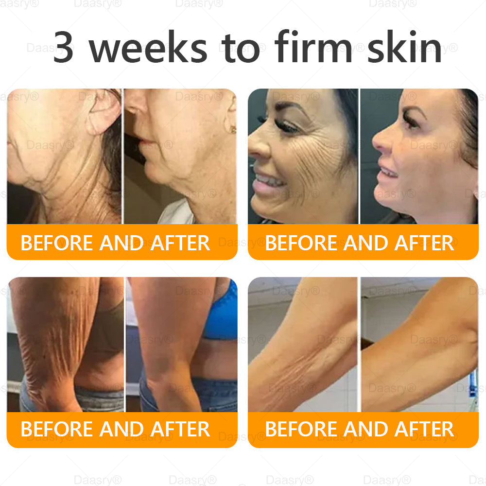 🔥 🗽Made & Shipped from USA | Clinically Proven: Daasry® Bee Venom Treatment Cream with bee venom peptides, botulinum toxin, hyaluronic acid, and collagen💧. Targets wrinkles, fine lines, sagging, stretch marks, dark spots—firming, lifting and more