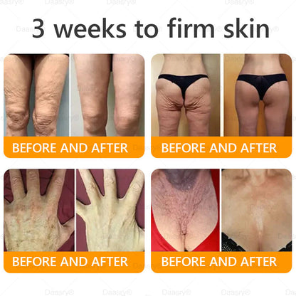 🔥 🗽Made & Shipped from USA | Clinically Proven: Daasry® Bee Venom Treatment Cream with bee venom peptides, botulinum toxin, hyaluronic acid, and collagen💧. Targets wrinkles, fine lines, sagging, stretch marks, dark spots—firming, lifting and more