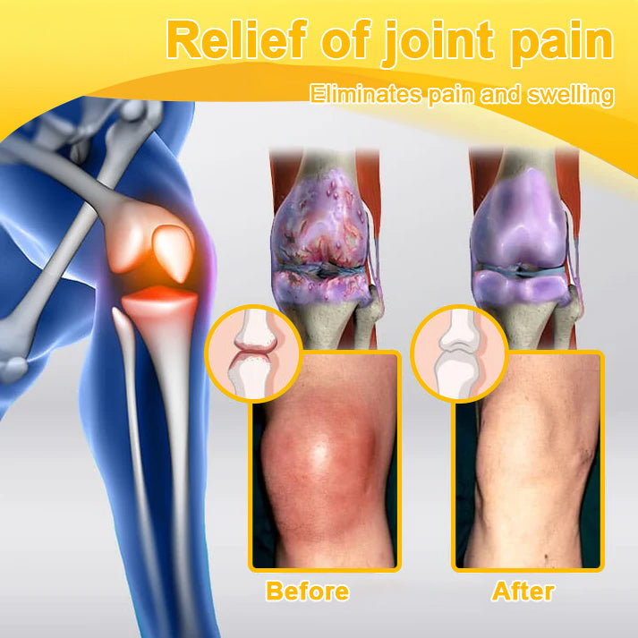 Aetheris™ Bee-Venom Pain-Relief Bone Healing Cream (Especially for older adults &AAOS recommends🧑‍⚕️)🐝🐝