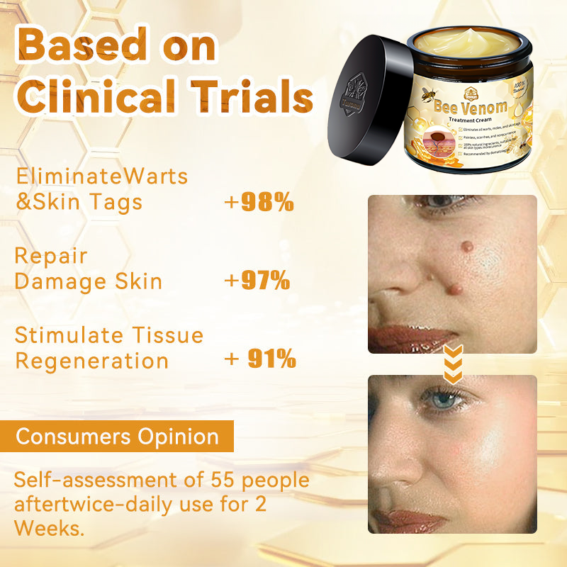 🏵️𝑇𝑢𝑟𝑜𝑛𝑢™ Bee Venom Skin Treatment Cream（𝐴𝐴𝐷 𝑅𝑒𝑐𝑜𝑚𝑚𝑒𝑛𝑑𝑒𝑑）