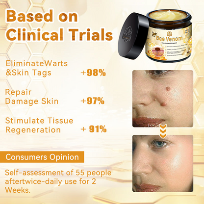 🏵️𝑇𝑢𝑟𝑜𝑛𝑢™ Bee Venom Skin Treatment Cream（𝐴𝐴𝐷 𝑅𝑒𝑐𝑜𝑚𝑚𝑒𝑛𝑑𝑒𝑑）