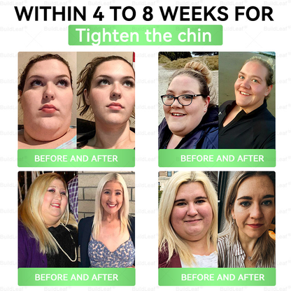US Online | Myo Clinic® 𝗚𝗟𝗣-𝟭 𝟖-𝗶𝗻-𝟭 𝗦𝗹𝗶𝗺 & 𝑯𝒆𝒂𝒍𝒕𝒉𝐲 𝑶𝒓𝒂𝒍 𝑺𝒐𝒍𝒖𝒕𝒊𝒐𝒏(𝑂𝑛𝑐𝑒 𝑎 𝑑𝑎𝑦, 𝑣𝑖𝑠𝑖𝑏𝑙𝑒 𝑟𝑒𝑠𝑢𝑙𝑡𝑠 𝑖𝑛 7 𝑑𝑎𝑦𝑠)  ✅ 𝗦𝘂𝗽𝗽𝗼𝗿𝘁𝘀 𝗼𝗯𝗲𝘀𝗶𝘁𝘆, 𝗰𝗮𝗿𝗱𝗶𝗼𝘃𝗮𝘀𝗰𝘂𝗹𝗮𝗿 𝗵𝗲𝗮𝗹𝘁𝗵, 𝗱𝗶𝗮𝗯𝗲𝘁𝗲𝘀, 𝘀𝗹𝗲𝗲𝗽 𝗮𝗽𝗻𝗲𝗮, 𝗴𝘂𝘁 𝗵𝗲𝗮𝗹𝘁𝗵, 𝗷𝗼𝗶𝗻𝘁 𝗶𝘀𝘀𝘂𝗲𝘀, 𝐰𝐡𝐢𝐥𝐞 𝐚𝐥𝐬𝐨 𝐟𝐢𝐫𝐦𝐢𝐧𝐠 𝐭𝐡𝐞 𝐬𝐤𝐢𝐧 𝐚𝐧𝐝 𝐛𝐨𝐨𝐬𝐭𝐢𝐧𝐠 𝐞𝐧𝐞𝐫𝐠𝐲.